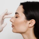 rinoplastia